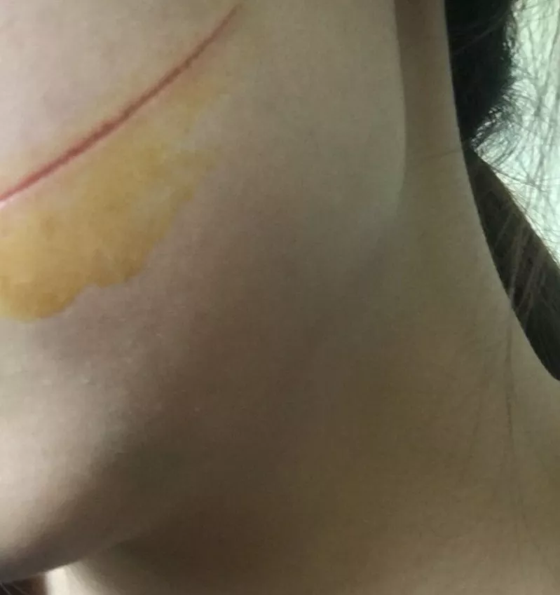 女孩經(jīng)過廣場臉上瞬間鮮血直流 監(jiān)控顯示兇手是它