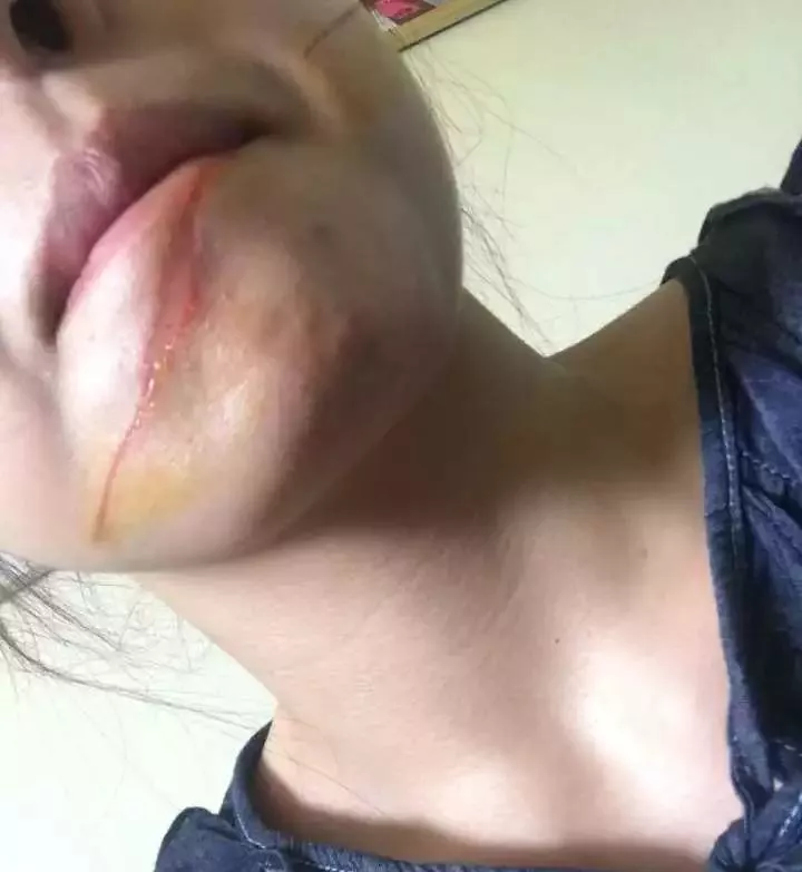 女孩經(jīng)過廣場臉上瞬間鮮血直流 監(jiān)控顯示兇手是它