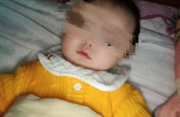 不到1岁的孩子患罕见病，希望好心人伸出援手
